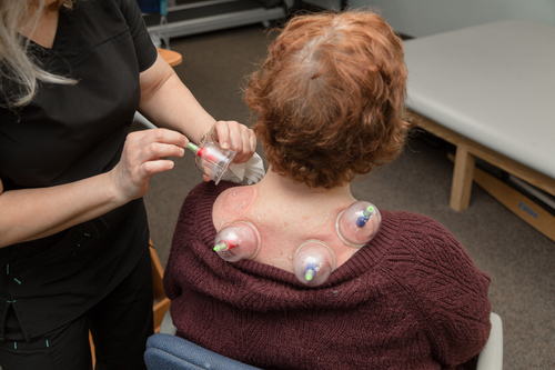 Myofascial CUpping AHP Physical Therapy norwalk ct